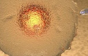 2026宁波试管婴儿技术哪家更胜一筹？三代试管成功率大揭秘！